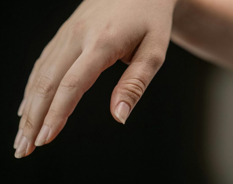 Kyste synovial du doigt : comment s’en débarrasser ?