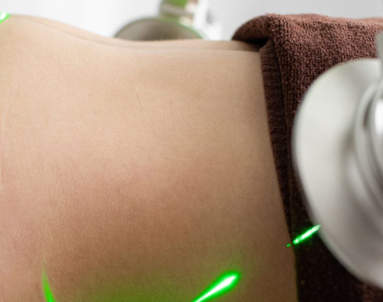 Quel prix pour une séance de cryolipolyse ?