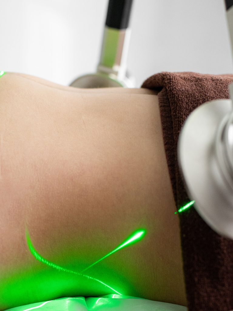 Quel prix pour une séance de cryolipolyse ?
