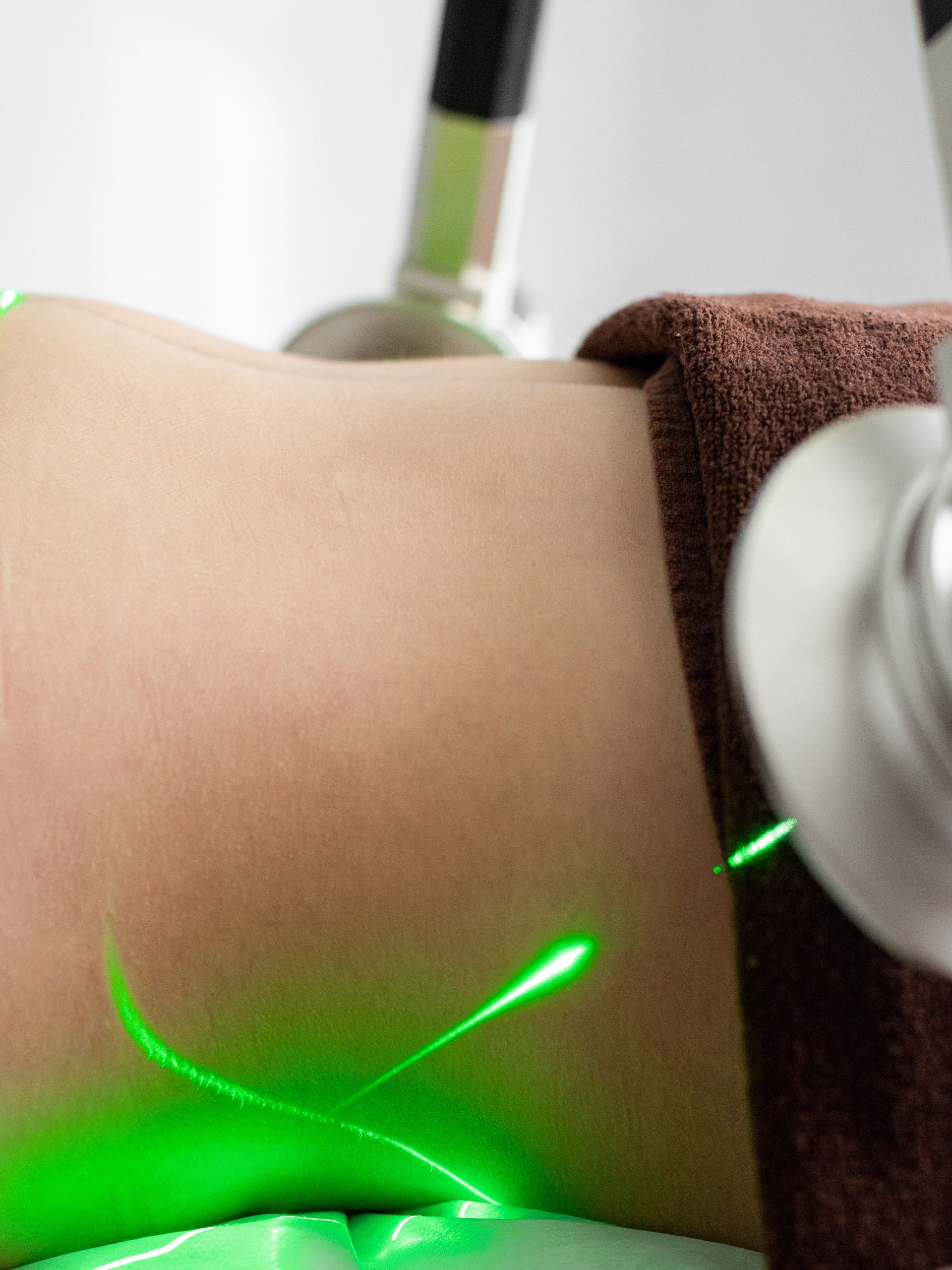 Prix d'une séance de cryolipolyse