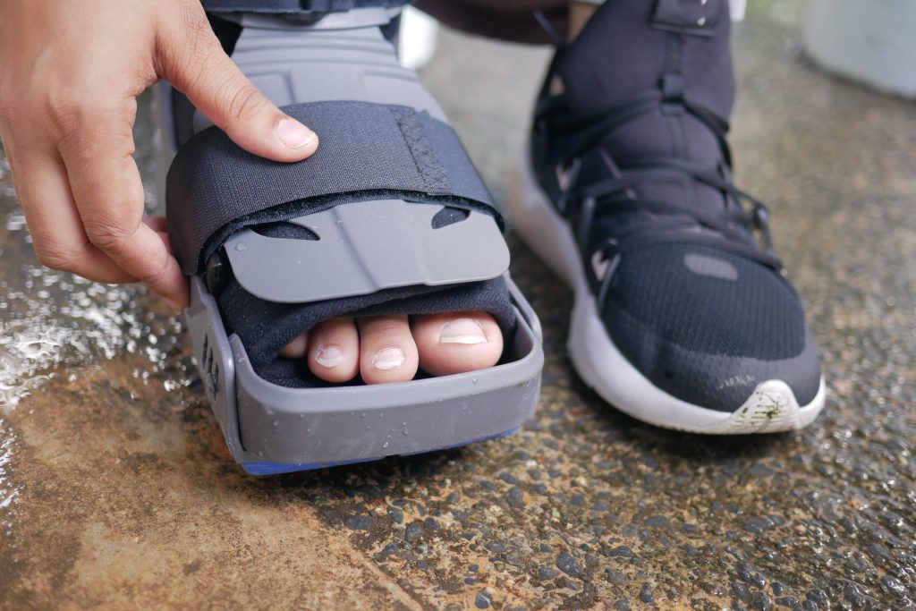 Fracture du gros orteil : comment savoir si c’est cassé ?