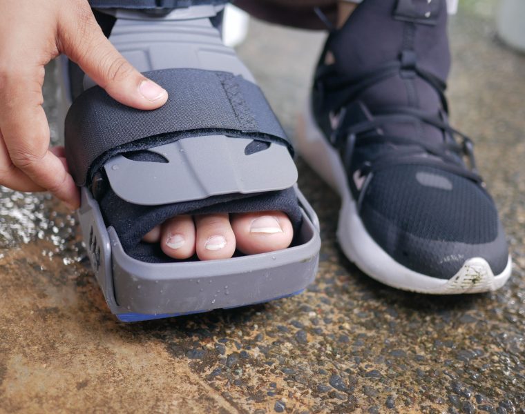 Fracture du gros orteil : comment savoir si c’est cassé ?