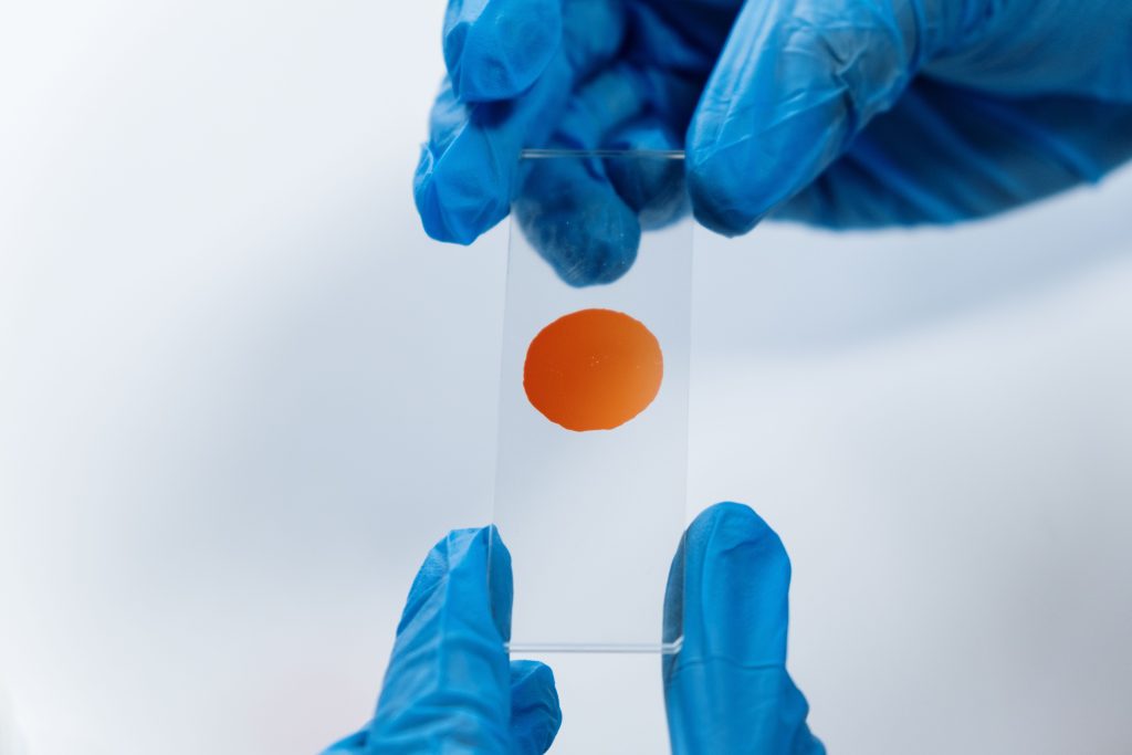 Frotti inflammatoire : c’est grave ou pas ?