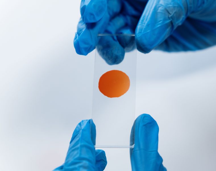 Frotti inflammatoire : c’est grave ou pas ?