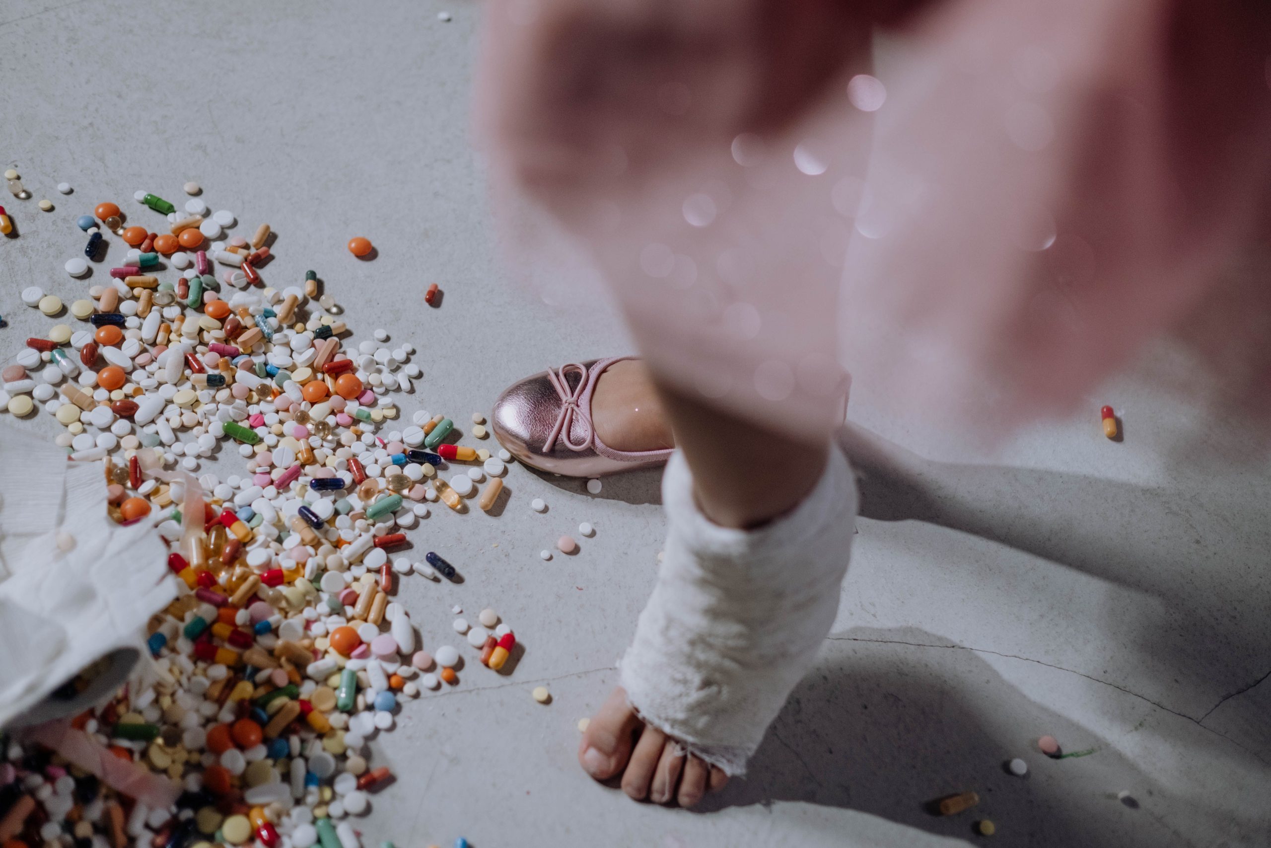 Pied d'enfant plâtré avec médicaments