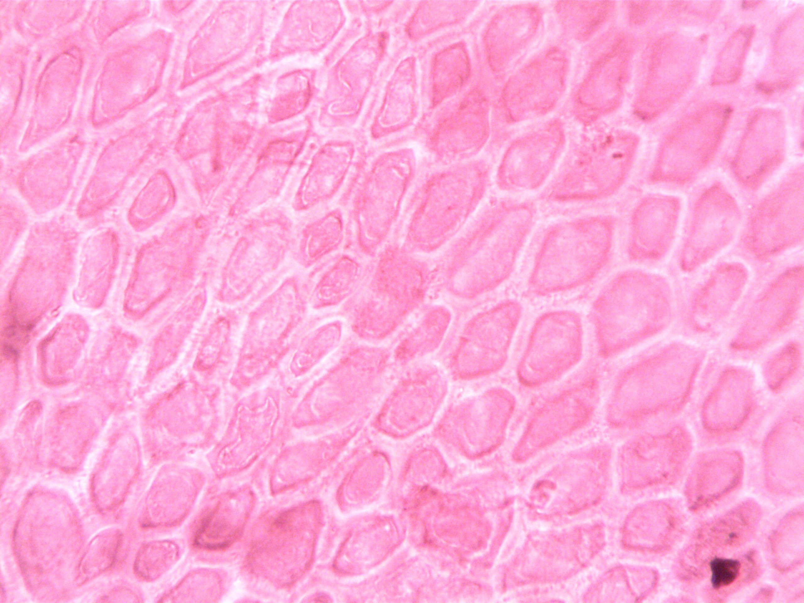 Structures cellulaires roses observées au microscope