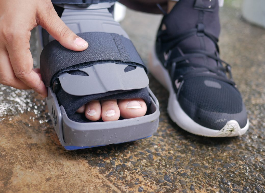 Mal au scaphoïde du pied : c’est quoi et que faire ?